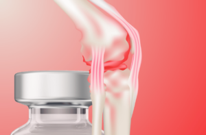 Peptides for arthritis and joint pain featured image